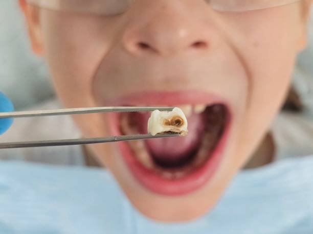 Best Cracked Tooth Emergency Dentist  in Loris, SC